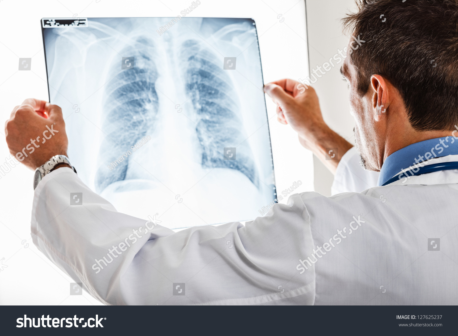 PowerPoint Template X Ray Doctor Examining A Ijonjmjko