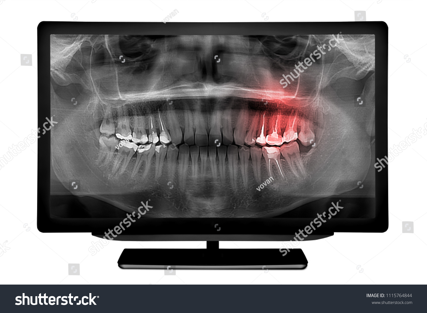 PowerPoint Template Dental Radiology Computer Ropot iiimonlpll 