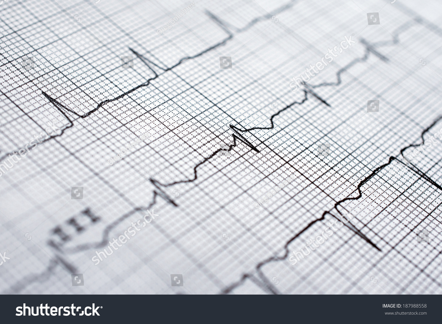 PowerPoint Template: ekg - ecg diagram (ipouppmmp)