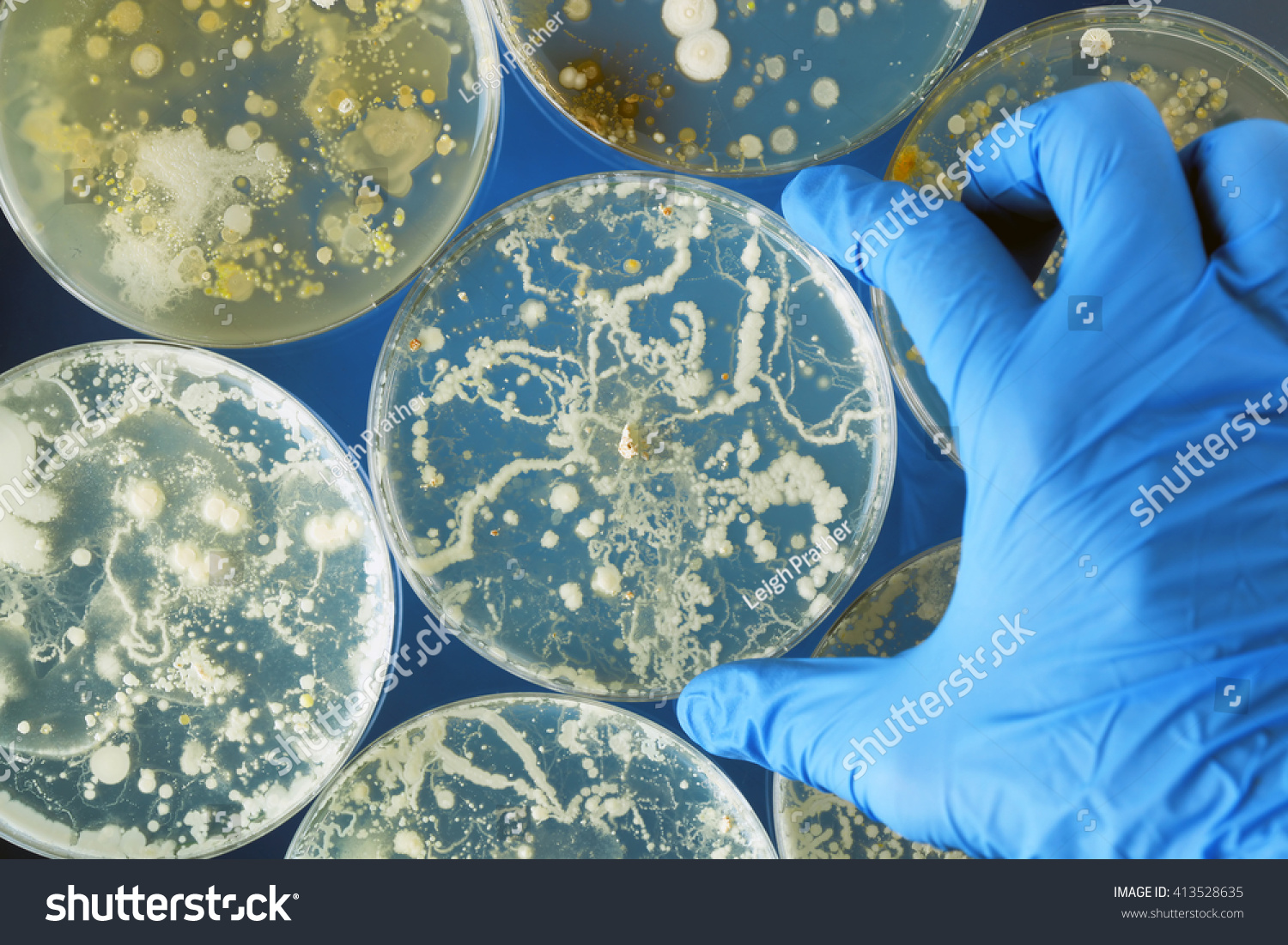 powerpoint-template-biology-fungi-medical-fungus-likmjpnkm